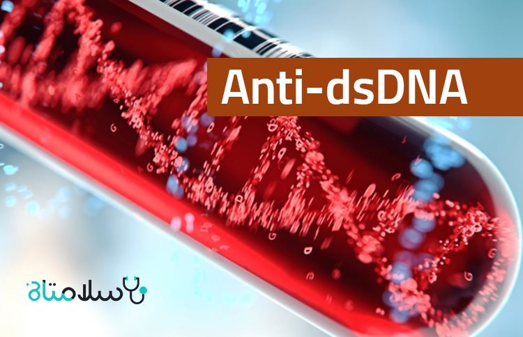 آزمایش Anti-dsDNA