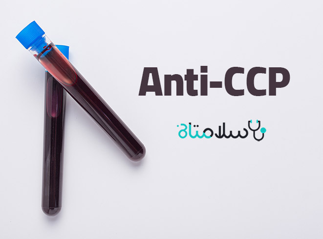 anti-ccp در آزمایش