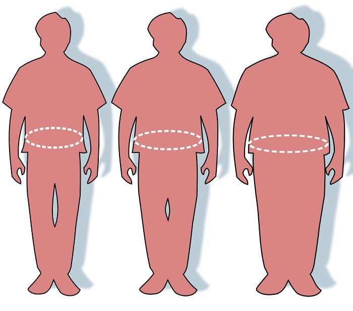 چاقی در سندرم متابولیک