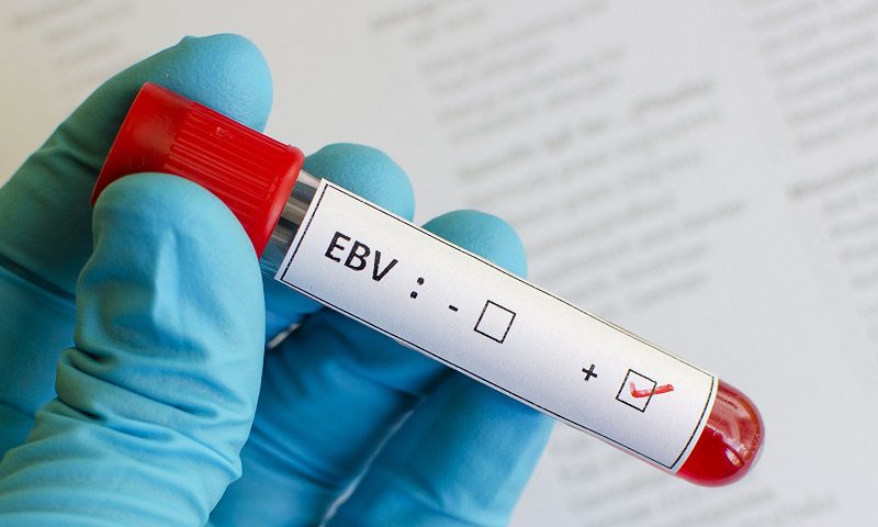 ویروس EBV